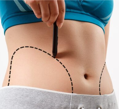 Liposuction doctor in Indore