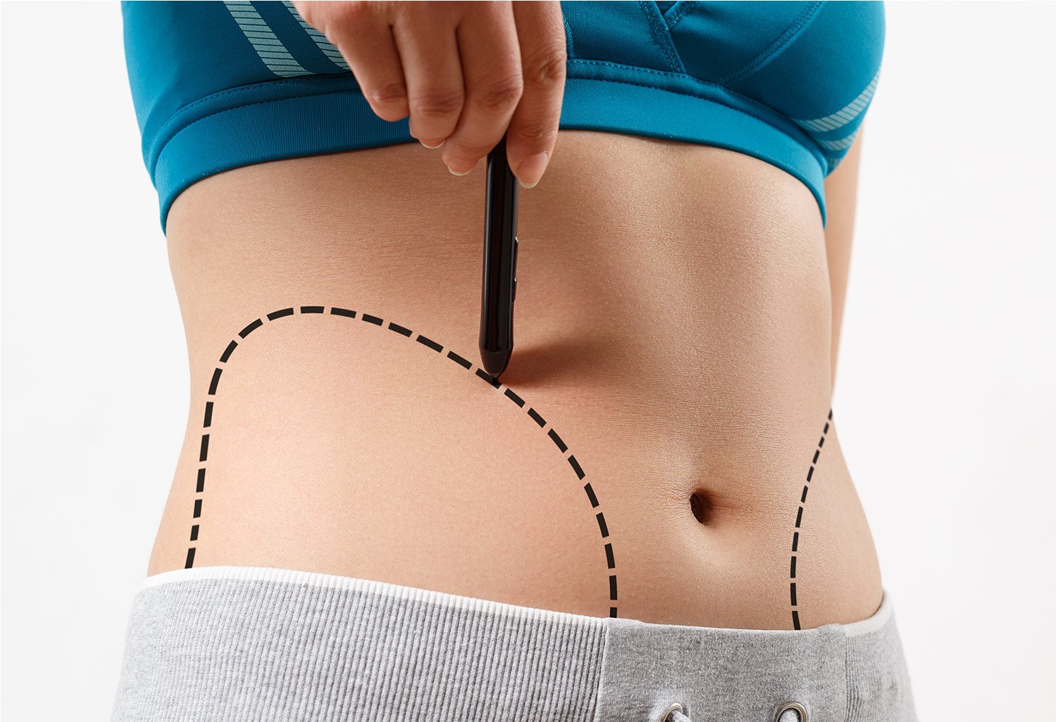 Liposuction doctor in Indore