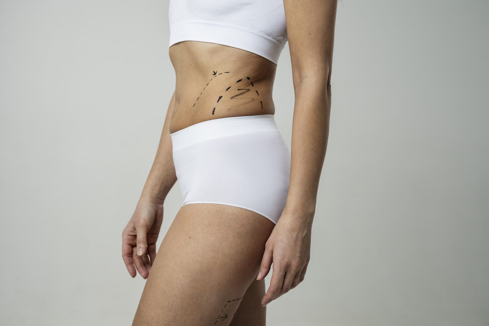 Liposuction doctor in Indore
