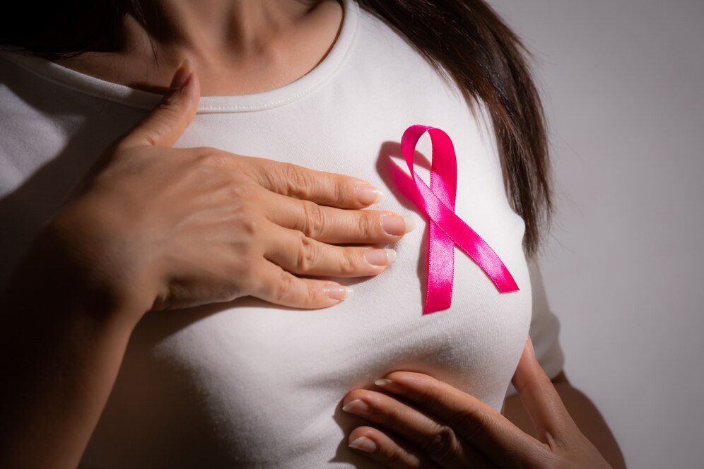 Breast Cancer Treatment in Indore