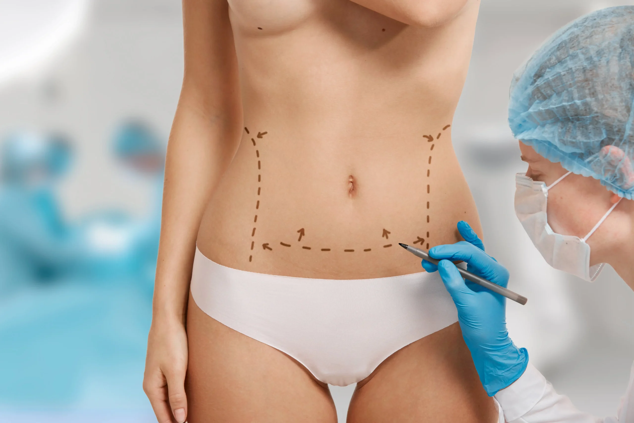 Tummy Tuck Surgery in Indore