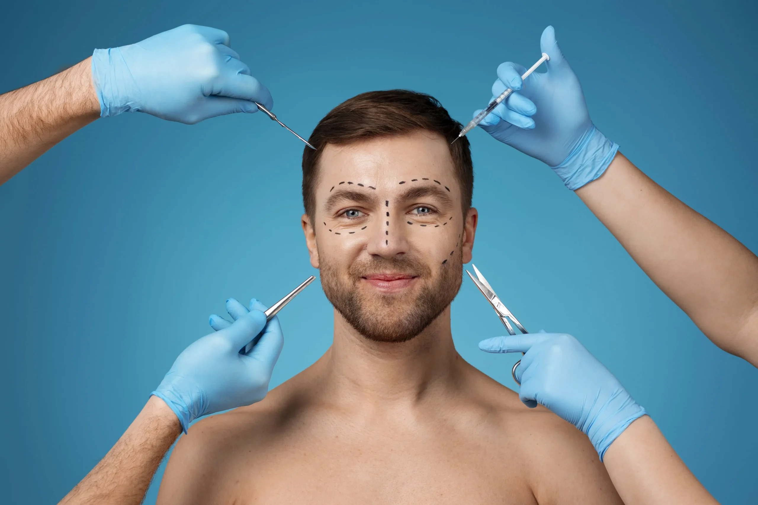 Facelift for men before and after results – Dr. Sanjay Kucheria